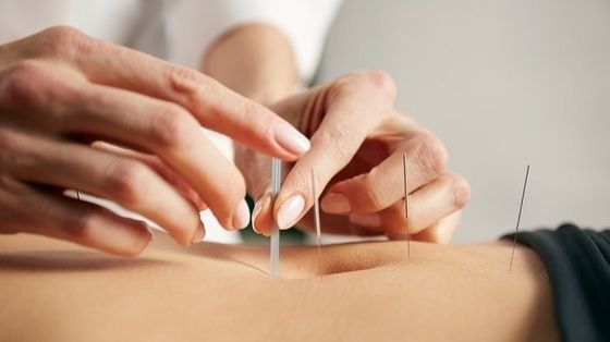 0.16ميلي متر سوزن هاي طب سوزني داخل پوست نقره اي براي تسکين درد