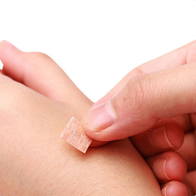 سوزن های تک نوک تیز اکوپونکتوری CE TUV ISO GMP برای طب سنتی چینی