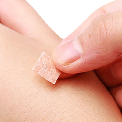 سوزن های طب سوزنی بسته بندی مقدار 100 قطعه در هر جعبه فشار و آزاد کردن روش ورودی سوزن های طب سوزنی فشار